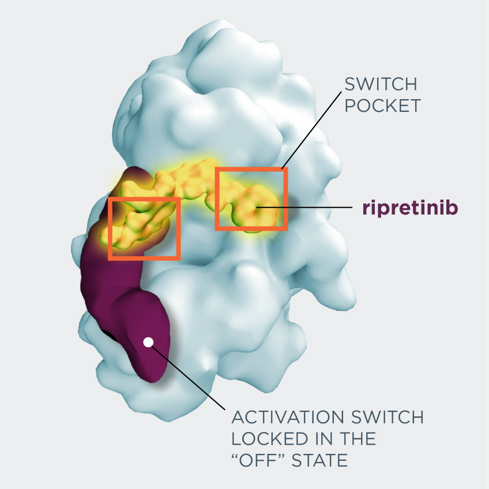 A new study has shown that patients taking the kinase inhibitor ripretinib, which turns off an activation switch to help prevent drug resistance in patients with gastrointestinal stromal tumors, had improved rates of survival versus patients taking placebo. (Deciphera Pharmaceuticals).