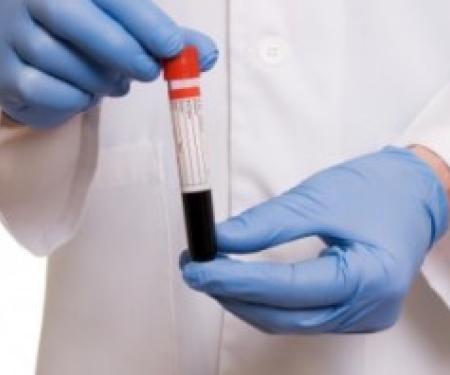 A close up photo of a medical professional's torso, holding a vial of blood in front of them with latex gloved hands.