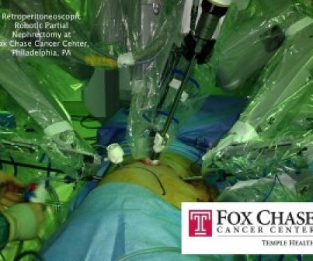 A photograph of a retroperitoneoscope approaching someone's back from all angles, performing a robotic surgery.