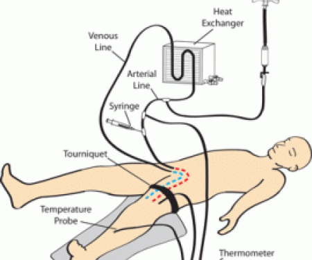 Link to /sites/default/files/styles/post_teaser_image_300x250_/public/images/blog/thumb/isolatedDiagram-269x300.gif?h=ae116200&itok=z0rNE6dh