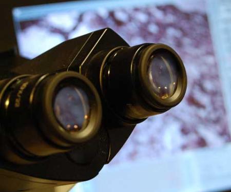 Link to /sites/default/files/styles/post_teaser_image_300x250_/public/images/news/thumb/thumb_research_microscope_11.jpg?h=7f412c8f&itok=YhUFp7hb