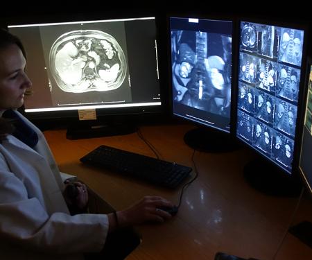A photograph of a medical professional in a dark room, looking at four screens displaying various medical imaging results.